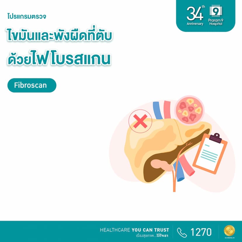 34th Anniversary: ตรวจไขมันและพังผืดที่ตับด้วยไฟโบรสแกน (Fibroscan)