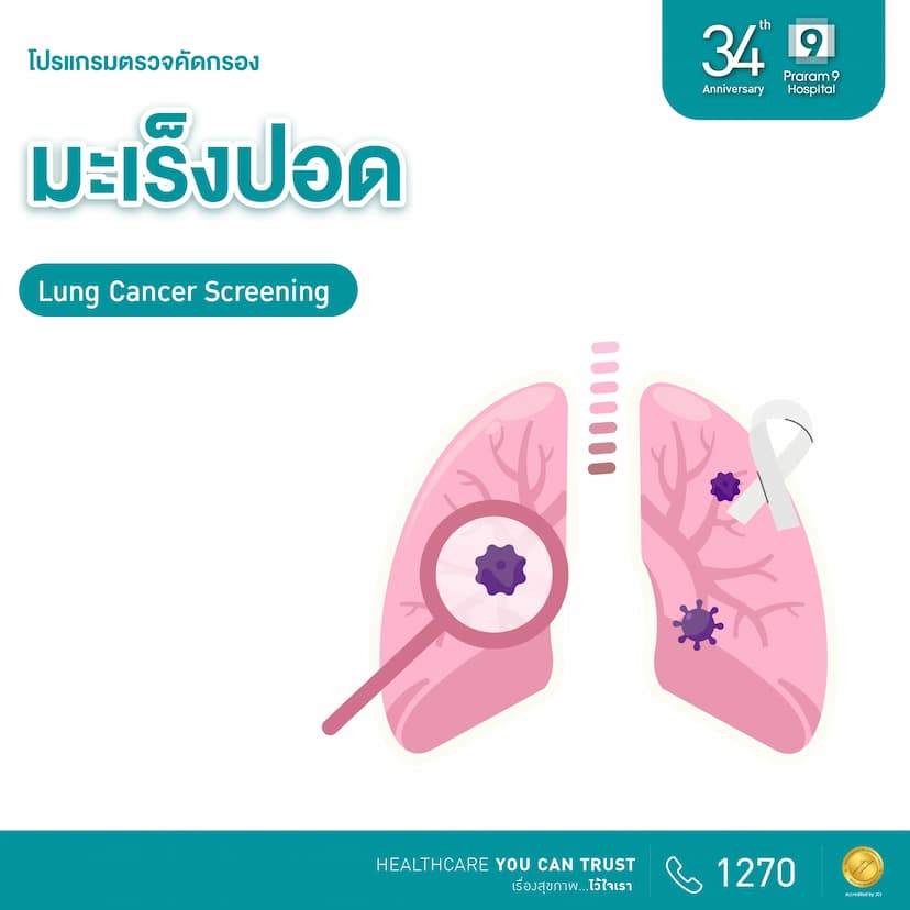 34th Anniversary : ตรวจคัดกรองมะเร็งปอด (CT Low-dose) 