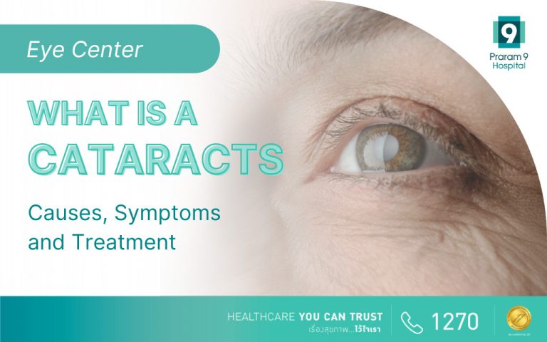 Cataracts: Causes, Symptoms, and Treatment