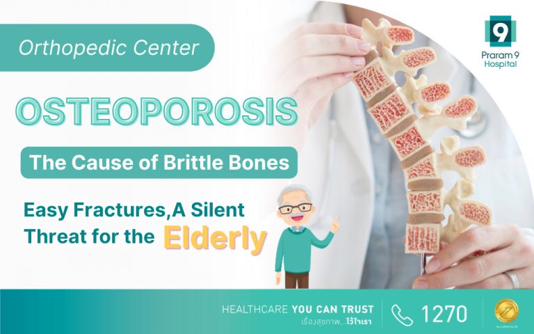 Osteoporosis: The Cause Of Brittle Bones, Easy Fractures, And A Silent ...