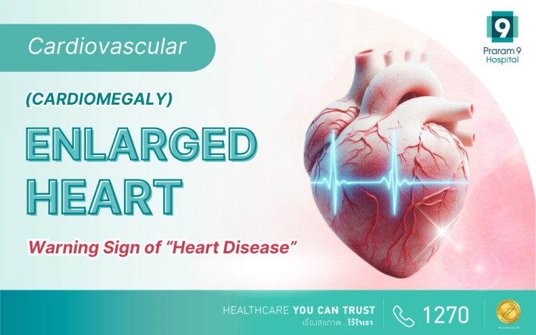 The Enlarged Heart (Cardiomegaly) a warning sign of heart disease