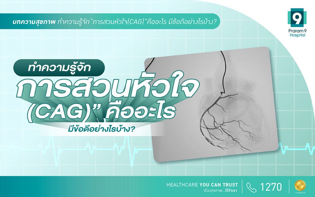 ทำความรู้จัก “การสวนหัวใจ (CAG)” คืออะไร มีข้อดีอย่างไรบ้าง?